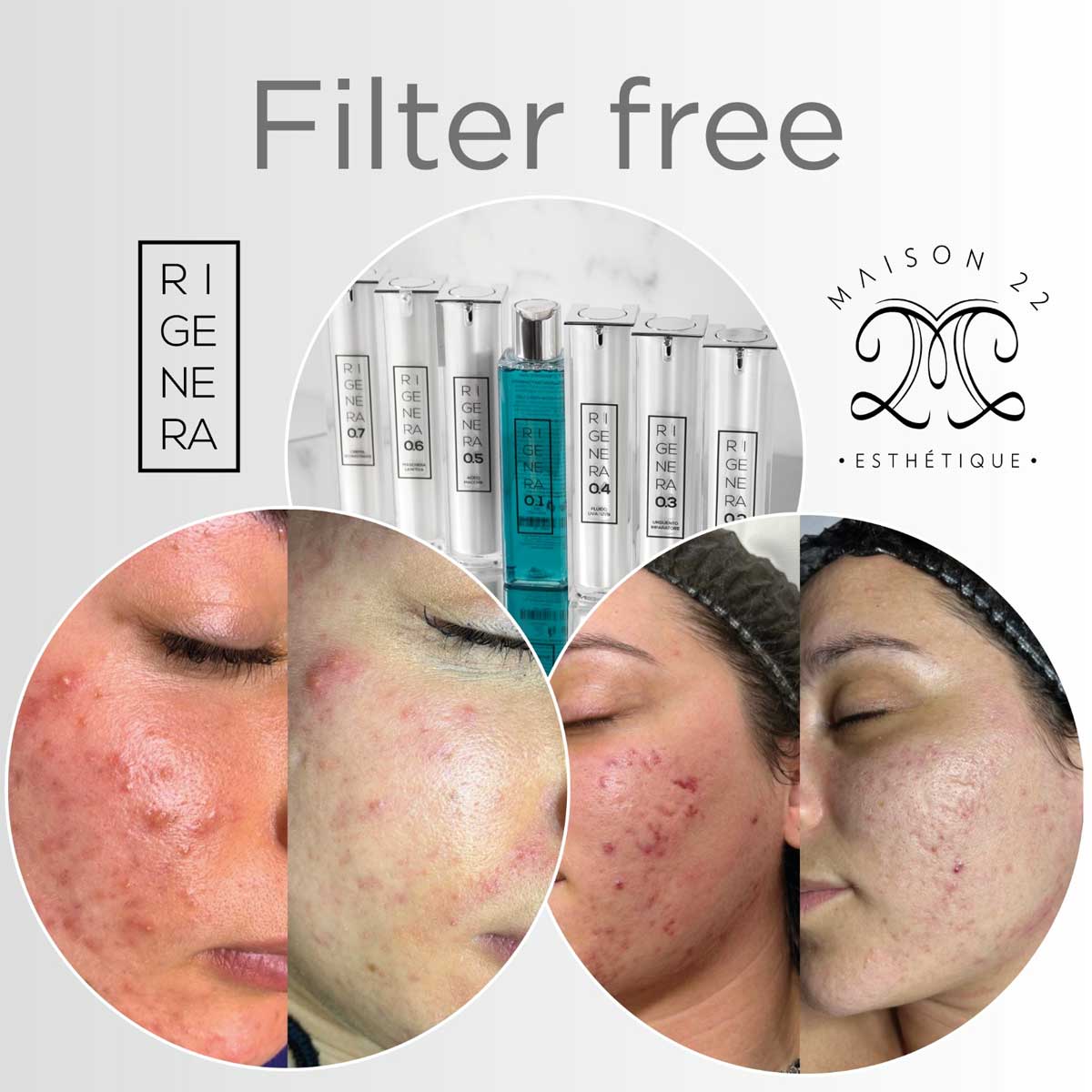 trattamento-viso-filter-free-opt